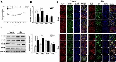 Age-Dependent Up-Regulation of HCN Channels in Spiral Ganglion Neurons Coincide With Hearing Loss in Mice